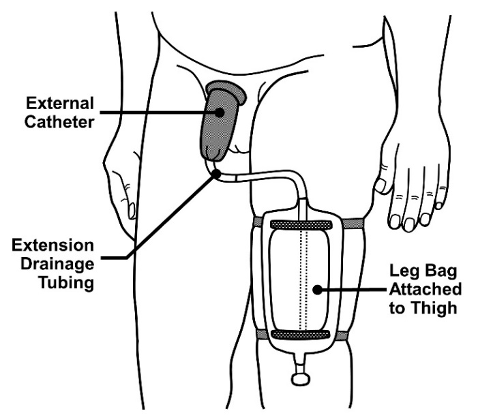 external_urinary_catheters